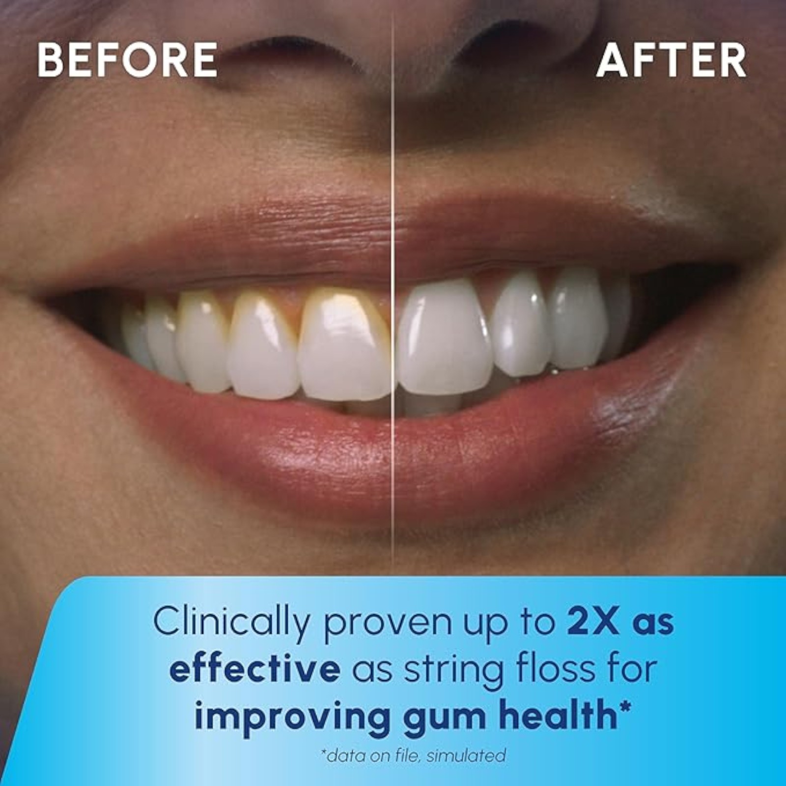 Waterpik Cordless Pearl Rechargeable Portable Water Flosser for Teeth, Gums, Braces Care and Travel with 4 Flossing Tips - ADA Accepted, WF-13 White, Packaging May Vary
