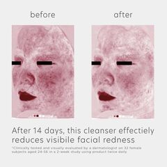 EltaMD Skin Recovery Amino Acid Foaming Facial Cleanser, Gentle Face Cleanser for Sensitive Skin 1Fl OZ